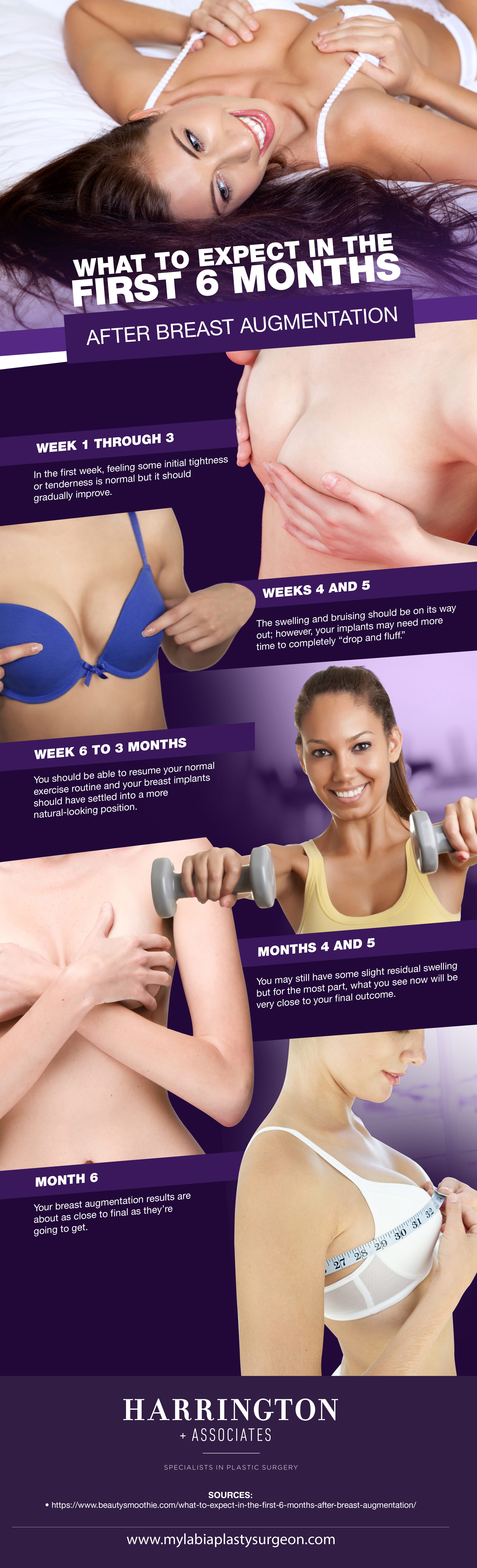 What to Expect in the First 6 Months After Breast Augmentation [Infographic]